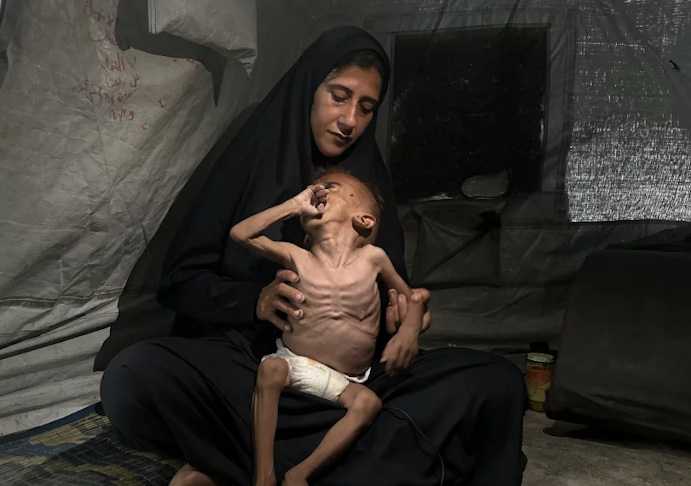 Woman holding a very emaciated child who us seems to be only skin and bones